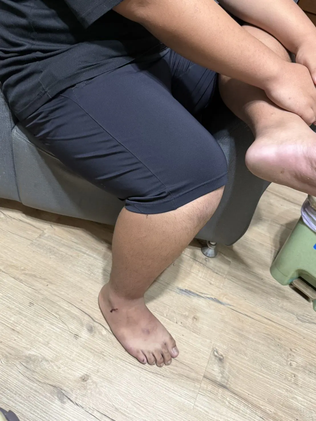 阿里山來吉村民日前遭鼬獾咬傷　衛生局所跨單位接力防疫